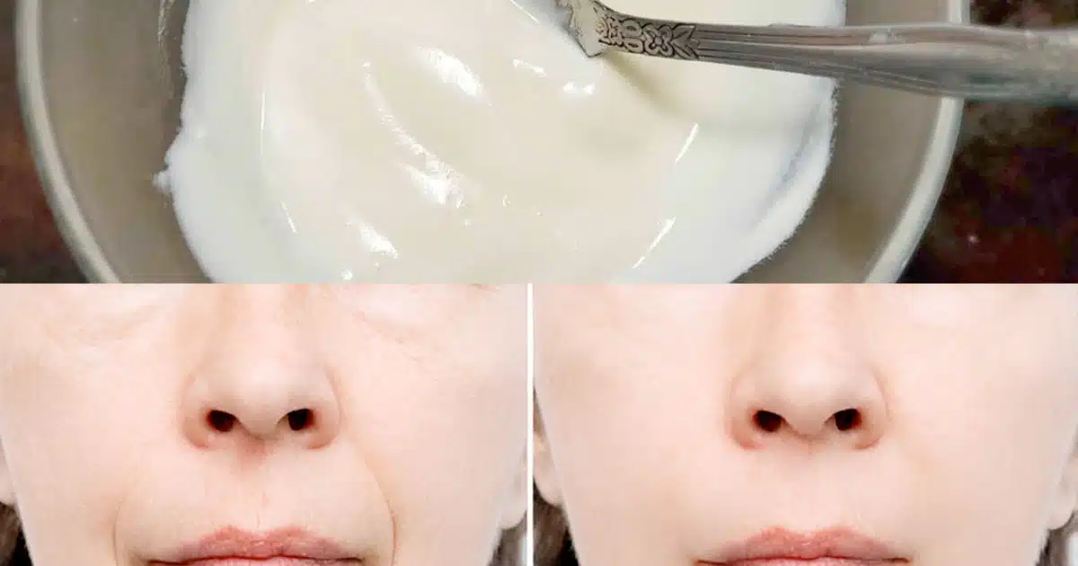 Crème au bicarbonate de soude pour le visage : éliminer les rides et taches avec ce remède