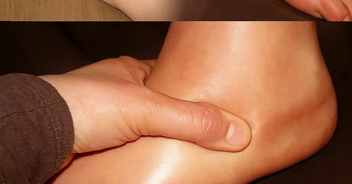 Débarrassez-vous rapidement des mains et des pieds gonflés : remèdes maison contre la rétention d'eau