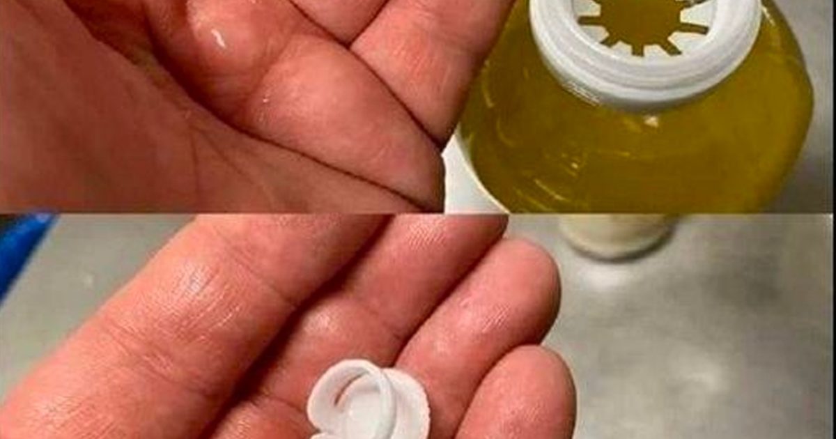 Découvrez la véritable utilité du bouchon d’huile