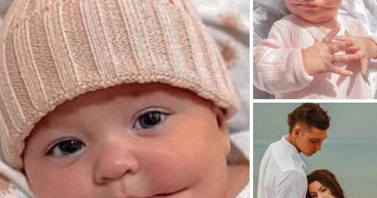 Découvrez l’histoire émouvante d’Ayla, un bébé né avec un sourire unique