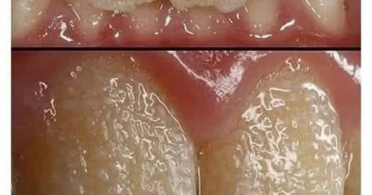 Des dents “bizarres” ? Et si c’était bien plus qu’un problème esthétique ?