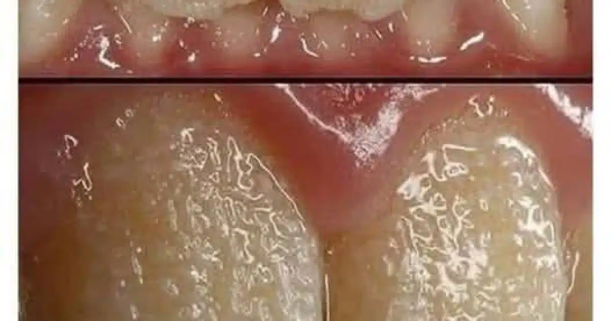 Des dents “bizarres” ? Et si c’était bien plus qu’un problème esthétique ?
