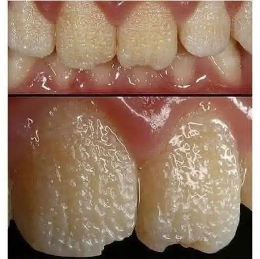 Des dents “bizarres” ? Et si c’était bien plus qu’un problème esthétique ?