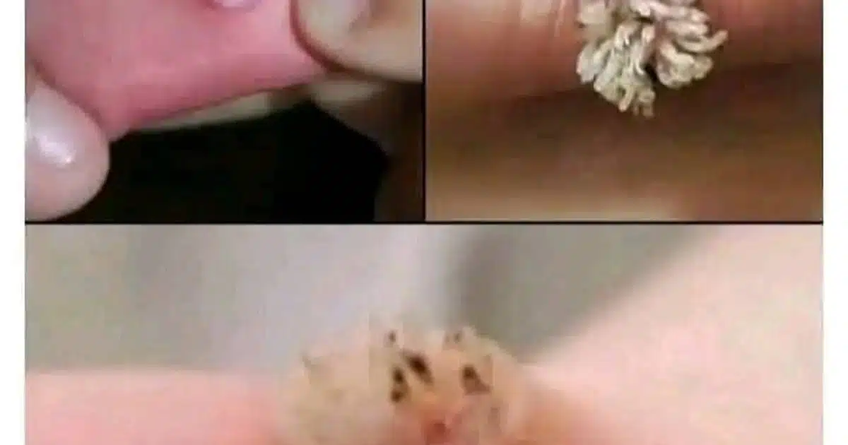 Des remèdes de grand-mère pour soigner l’herpès labial naturellement