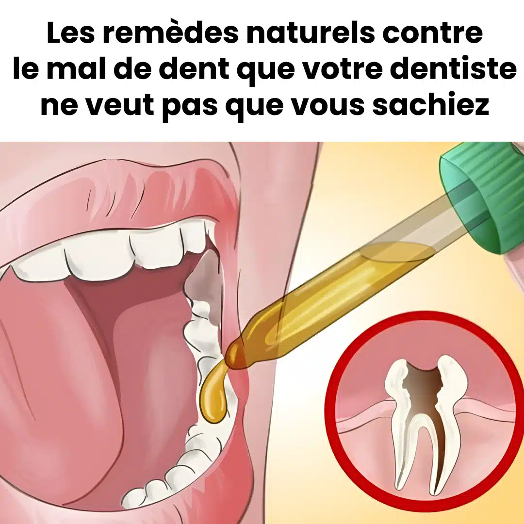 Des remèdes naturels contre le mal de dents