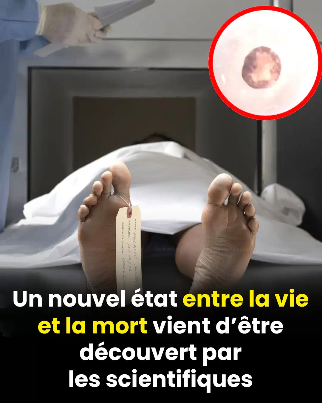 Des scientifiques découvrent un « troisième état » au-delà de la vie et de la mort, une avancée majeure