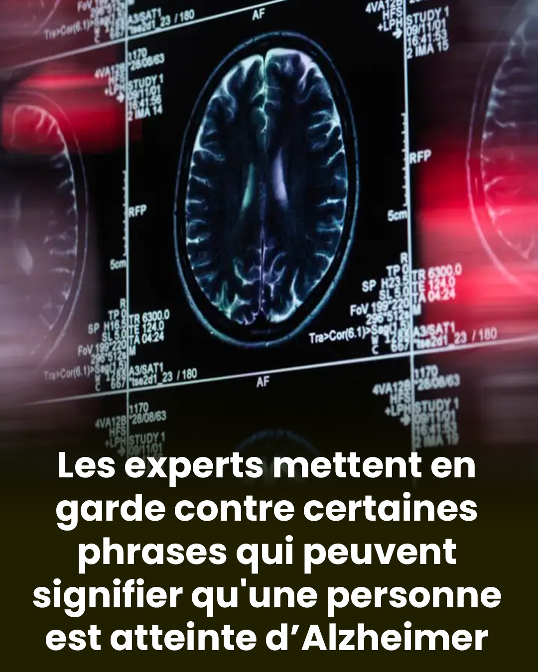 Des spécialistes signalent des phrases qui pourraient suggérer une démence (Alzheimer)