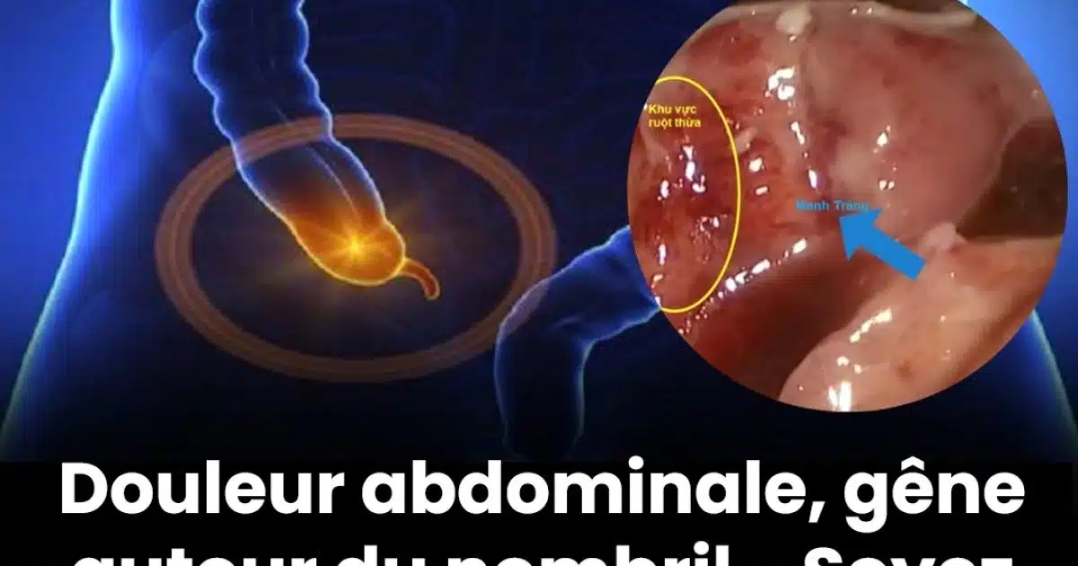 Douleurs abdominales sourdes, douleurs abdominales autour du nombril ? Voici ce qu’il faut savoir