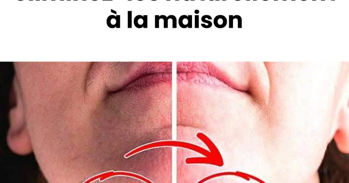 Éliminer les poils du menton sans agresser la peau : la solution naturelle