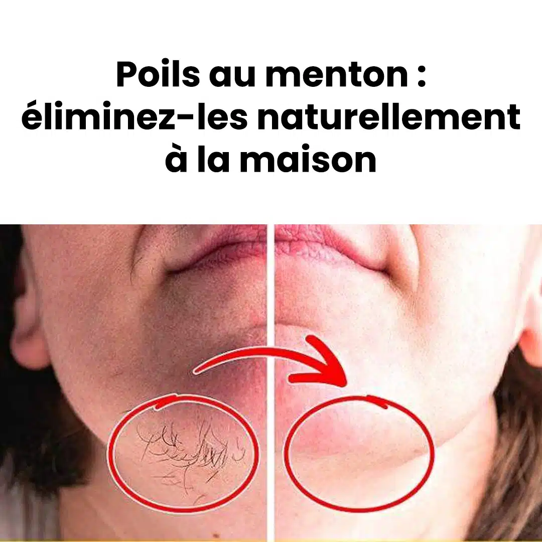 Éliminer les poils du menton sans agresser la peau : la solution naturelle