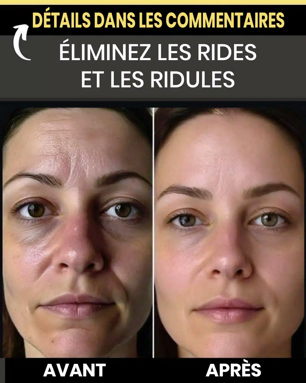 Éliminez instantanément les rides et les ridules : remèdes maison pour une peau lisse et jeune