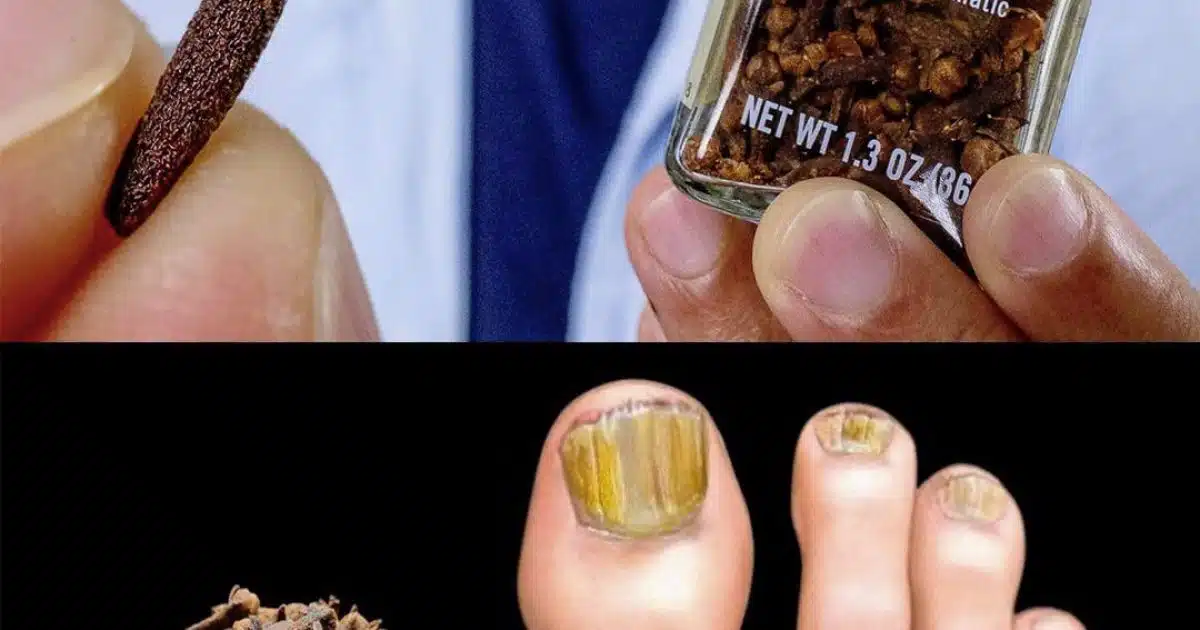 Éliminez les mycoses des ongles naturellement