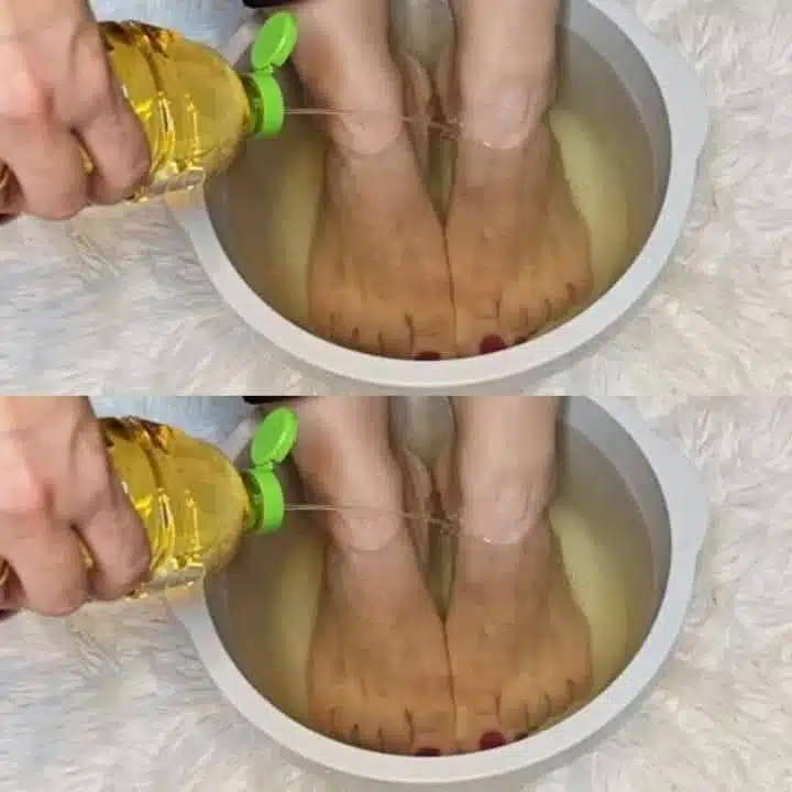 Elle a trempé ses pieds dans de l'eau vinaigrée et ne s'attendait pas à un tel effet !