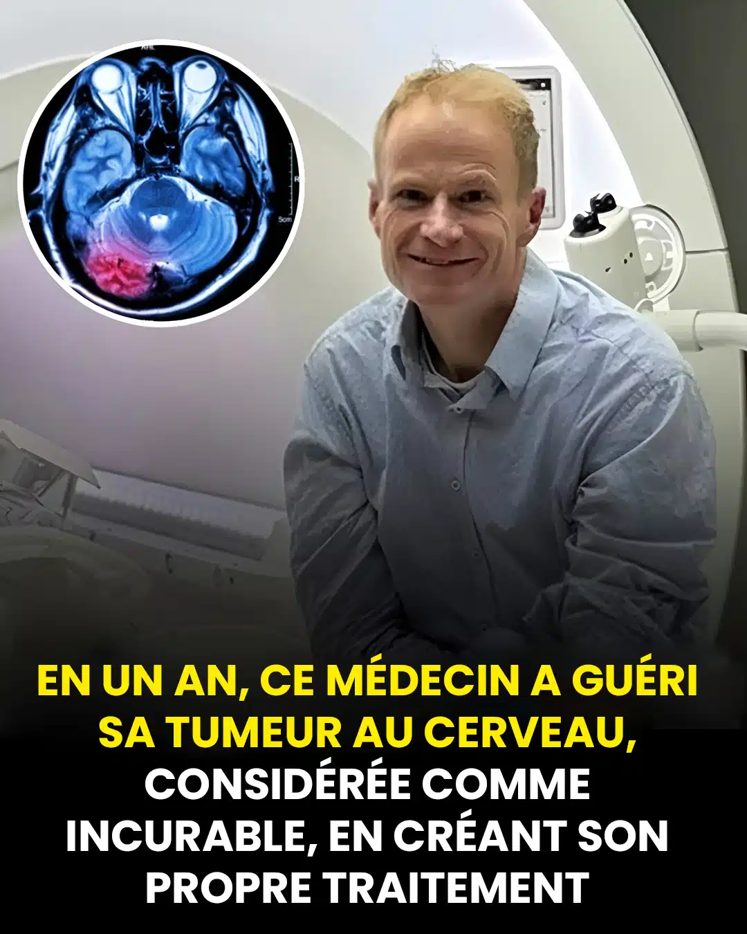 En un an, ce médecin célèbre a guéri sa tumeur au cerveau, considérée comme incurable, en créant son propre traitement