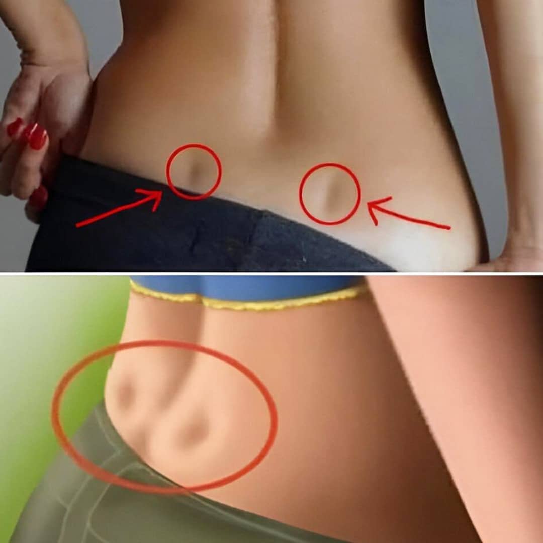 Fossettes dans le dos : quelles significations ?