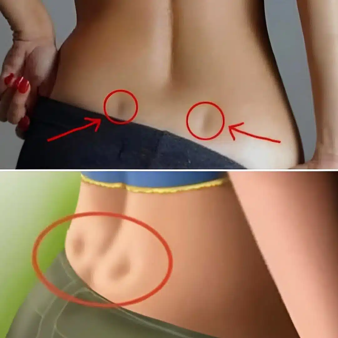 Fossettes dans le dos : quelles significations ?