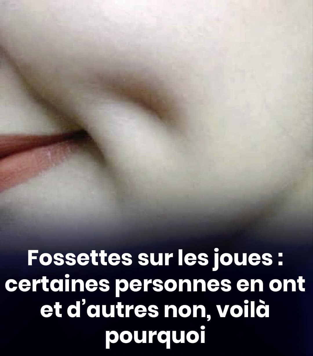 Fossettes sur la joue : pourquoi certaines personnes en ont et d'autres non ?