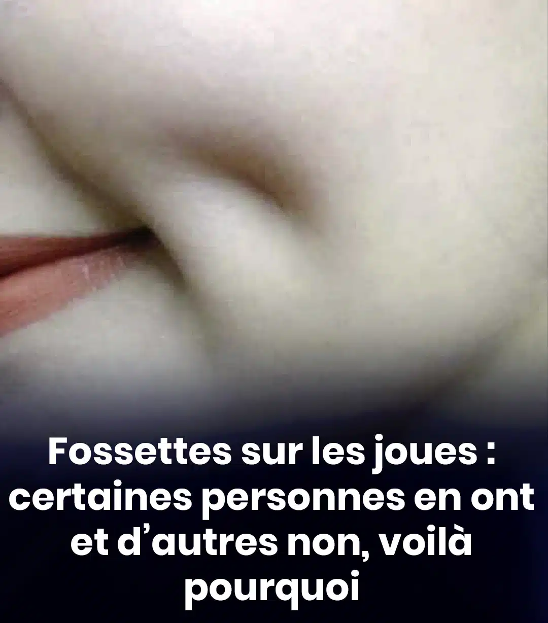 Fossettes sur la joue : pourquoi certaines personnes en ont et d'autres non ?