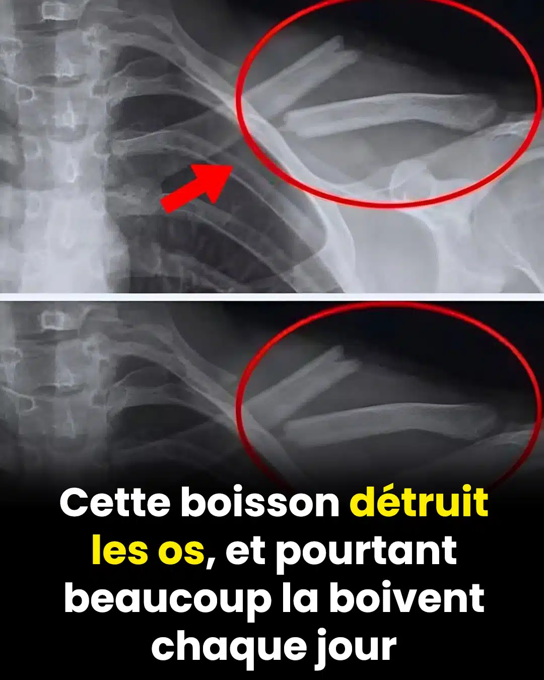 Il fragilise vos os, surcharge votre foie et attaque votre cœur… et pourtant, beaucoup le font chaque jour