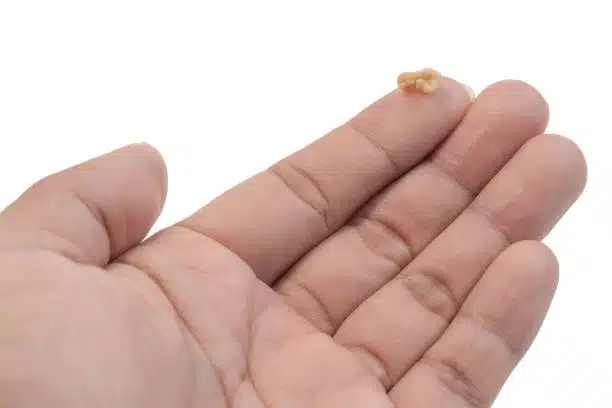 Femme se gargarisant