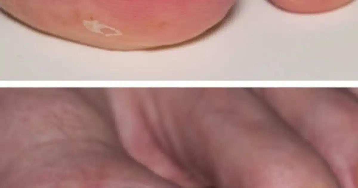 J'ai des rougeurs et des douleurs sur les bords de mes ongles de pieds. Que puis-je faire ?