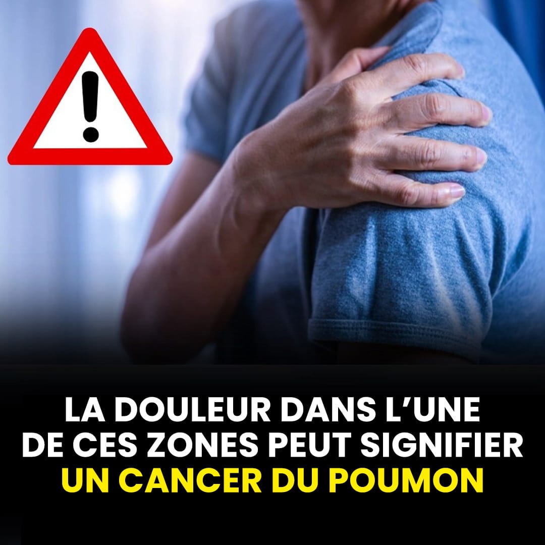 La douleur dans l’une de ces zones peut signifier un cancer du poumon