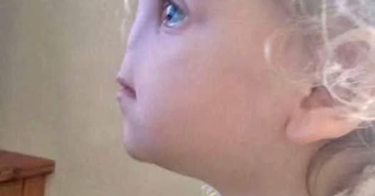 La maladie rare de cette petite fille : surmonter les défis et inspirer le changement