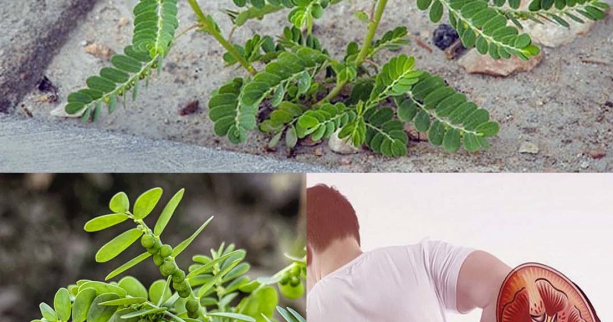 La plante miracle pour la santé : le remède naturel contre les calculs rénaux