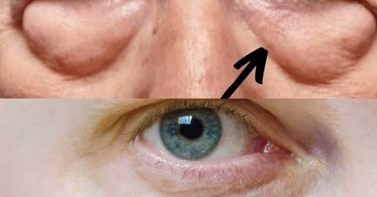 La vérité choquante sur les poches sous les yeux et les cernes : découvrez les causes les plus alarmantes !