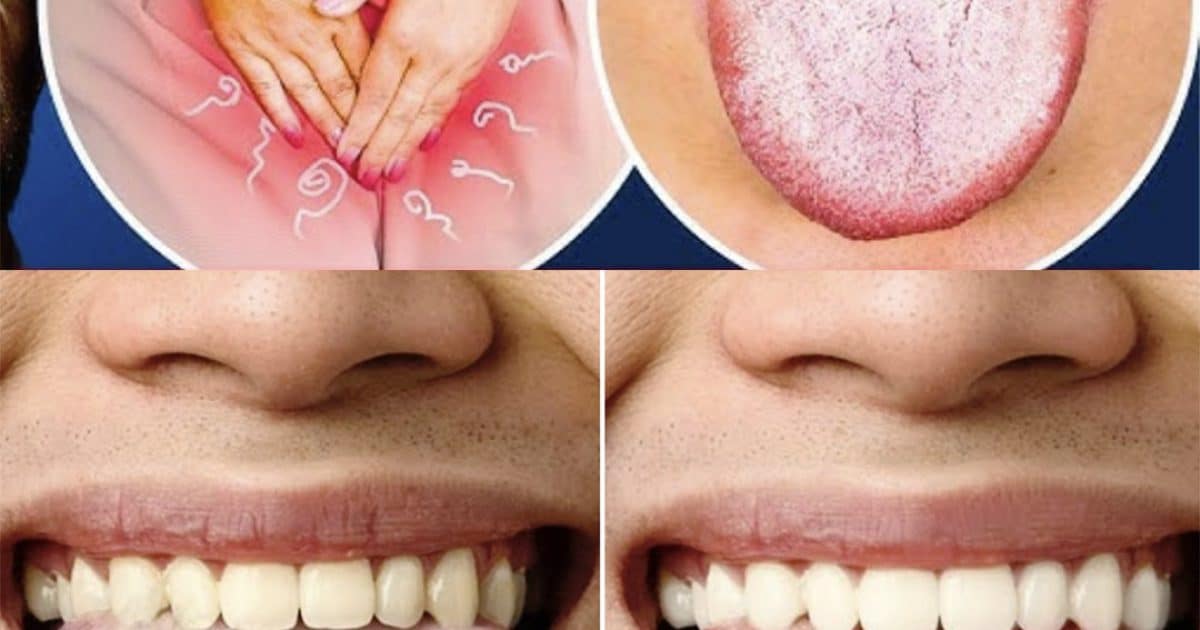 Langue blanche, fatigue persistante, troubles du sommeil, ballonnements… de quoi sont-ils les symptômes ?