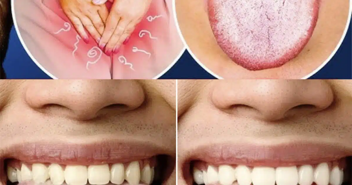 Langue blanche, fatigue persistante, troubles du sommeil, ballonnements… de quoi sont-ils les symptômes ?