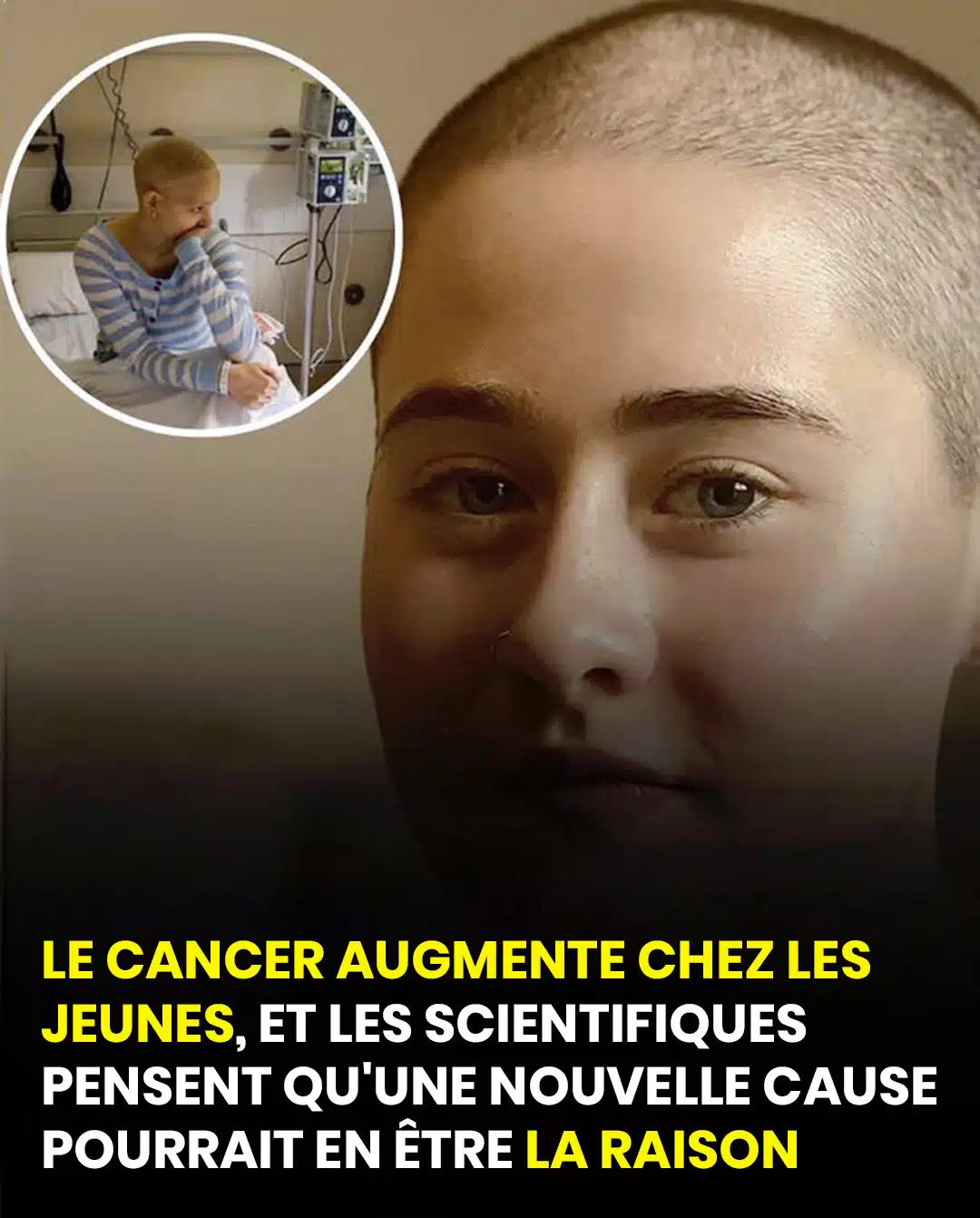 Le cancer augmente chez les jeunes, et les scientifiques pensent qu'une nouvelle cause pourrait en être la raison