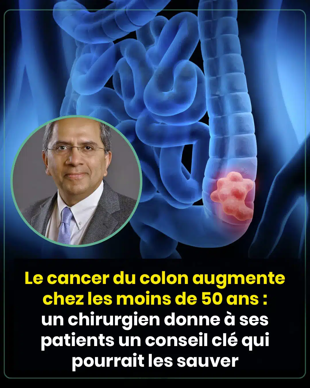 Le cancer du colon augmente chez les moins de 50 ans : un chirurgien donne à ses patients un conseil clé qui pourrait les aider