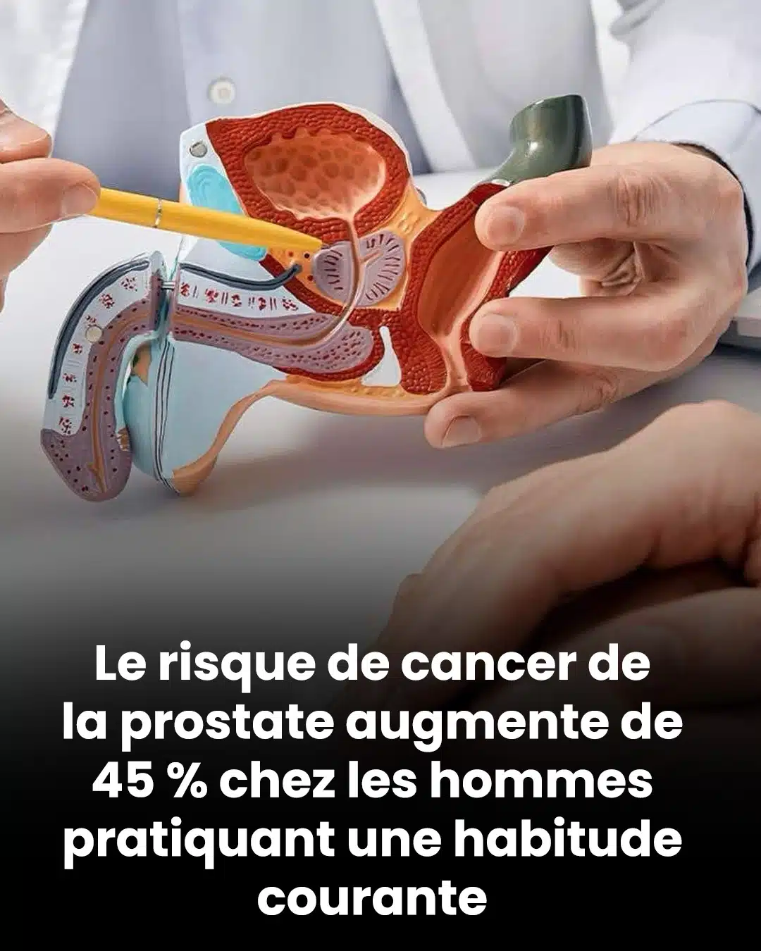 Le risque de cancer de la prostate augmente de 45 % chez les hommes en raison d'une pratique courante