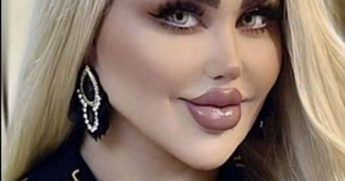 Les 43 opérations d'une femme pour ressembler à une Barbie se sont révélées contre-productives