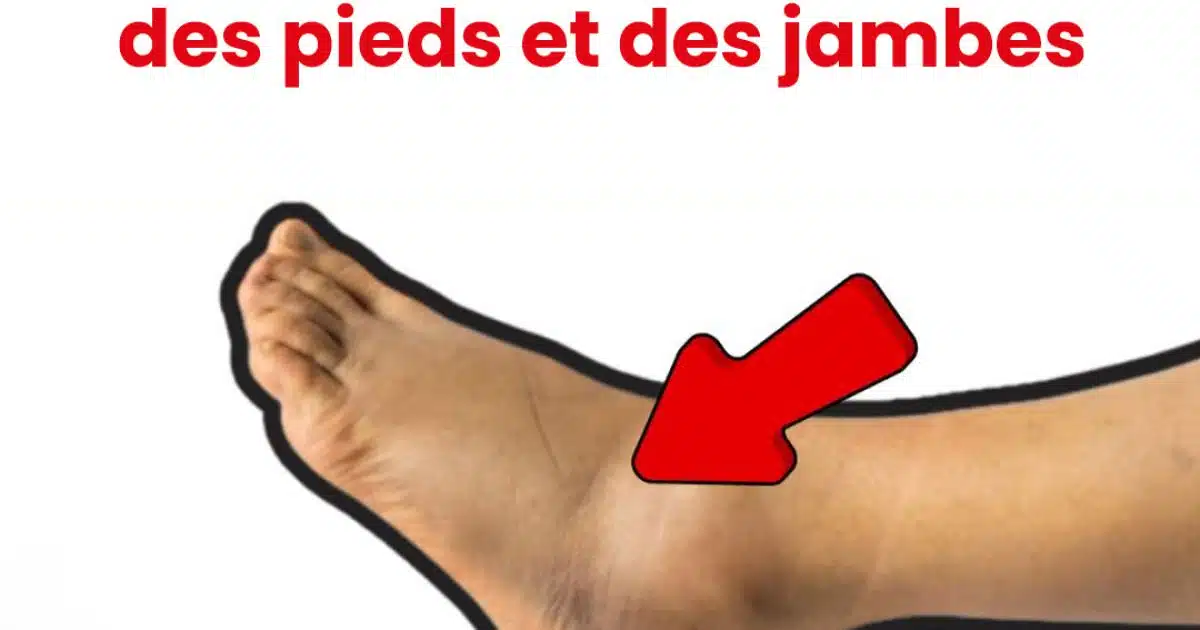 Les 5 meilleurs nutriments pour réduire le gonflement des pieds et des jambes