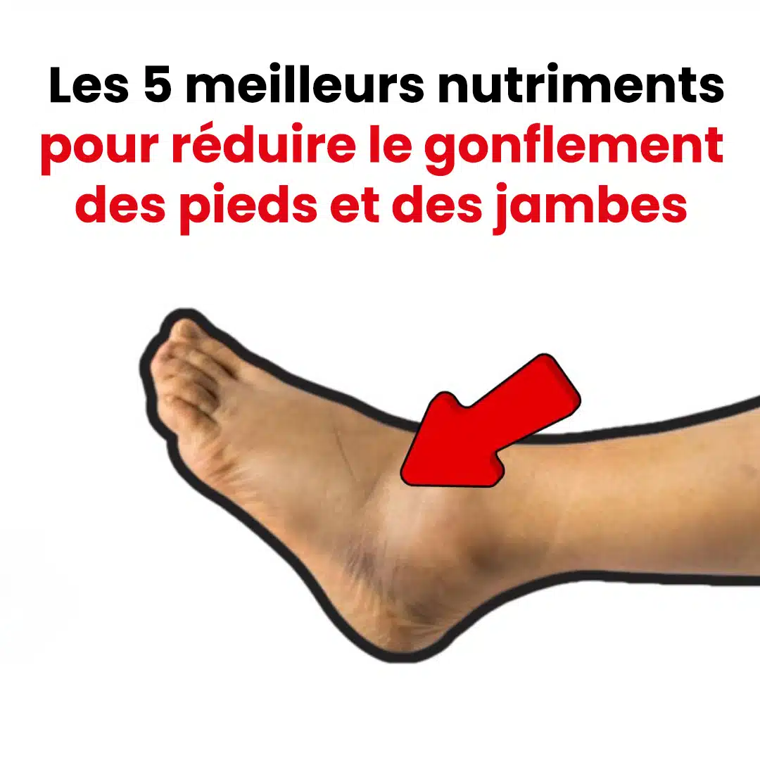 Les 5 meilleurs nutriments pour réduire le gonflement des pieds et des jambes