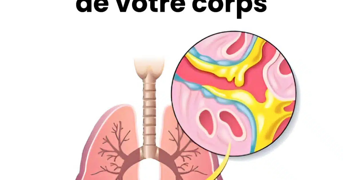 Les 7 meilleurs aliments qui éliminent le mucus de votre corps