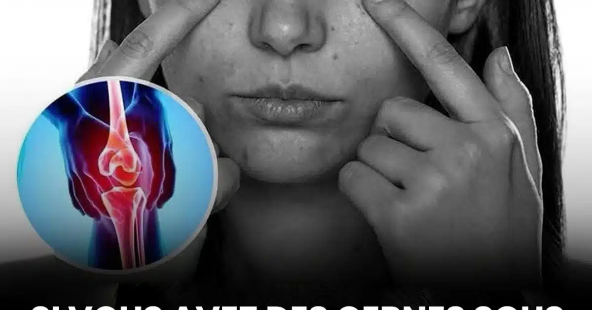 Les cernes sous les yeux pourraient être un signe discret d’un problème de santé