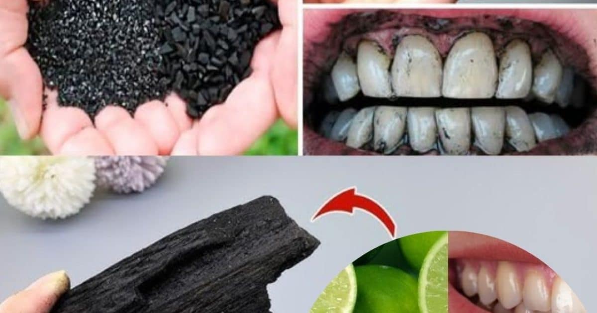 Les effets du charbon actif sur votre corps au-delà du blanchiment des dents