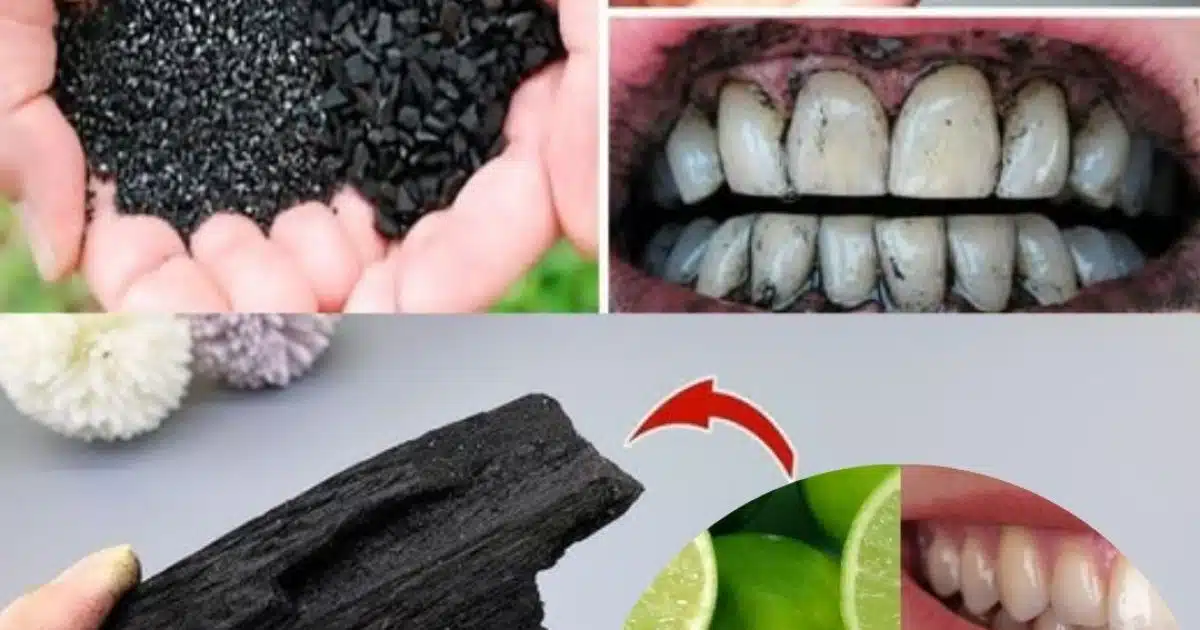 Les effets du charbon actif sur votre corps au-delà du blanchiment des dents