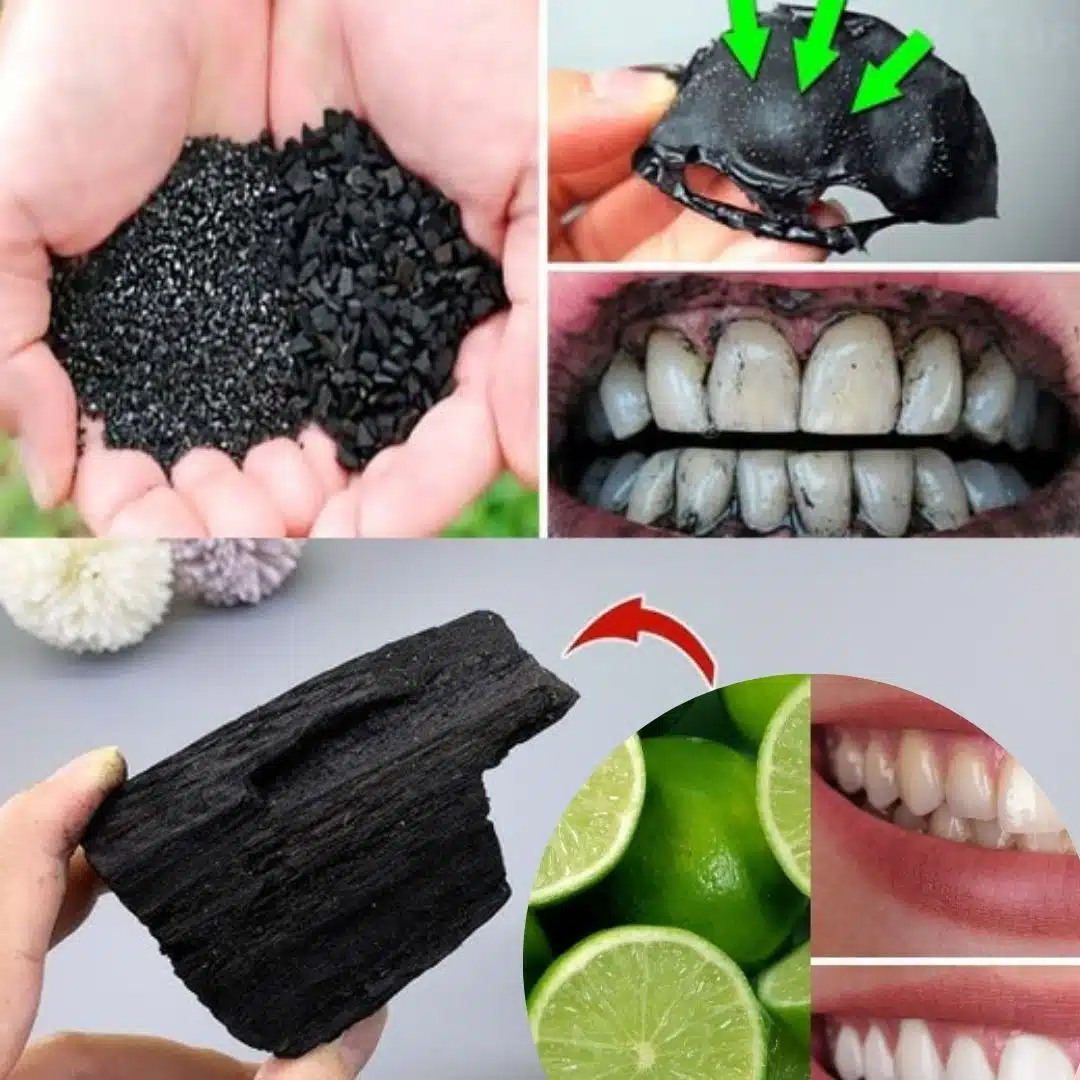 Les effets du charbon actif sur votre corps au-delà du blanchiment des dents