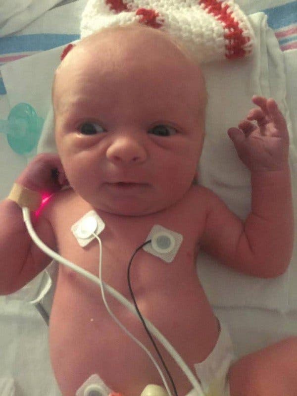 les médecins n’arrivent pas à croire ce qu’ils voient lorsque le bébé est né