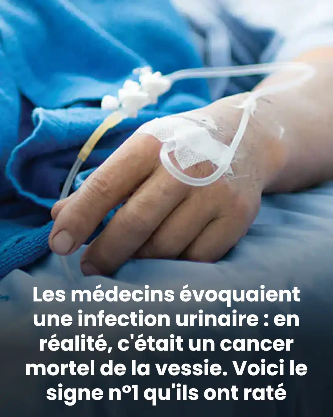 Les médecins soupçonnaient une infection urinaire : il s'agissait en réalité d'un cancer de la vessie mortel. Voici le signe n°1 qu'ils n'ont pas détecté