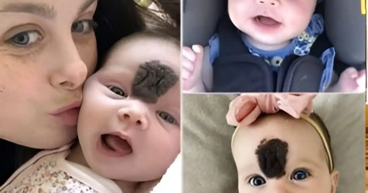 Les parents ont choisi de préserver leur bébé des regards indiscrets. Aujourd’hui, à deux ans, elle s’épanouit en une ravissante petite fille