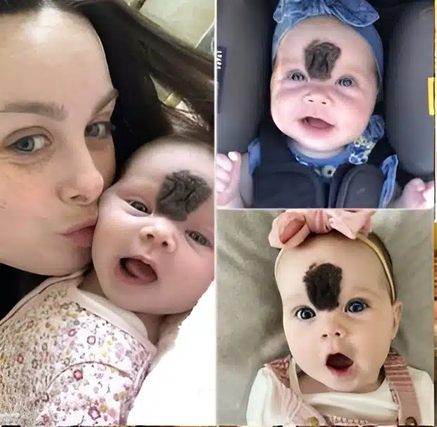 Les parents ont choisi de préserver leur bébé des regards indiscrets. Aujourd’hui, à deux ans, elle s’épanouit en une ravissante petite fille