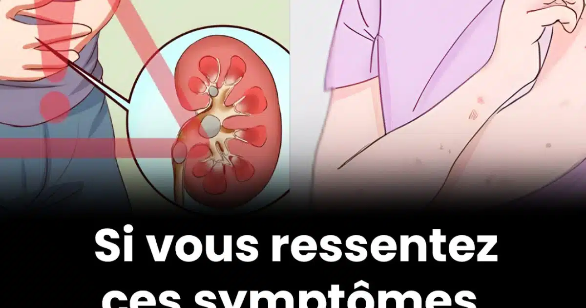 Les premiers signes d’un problème aux reins et comment vous protéger