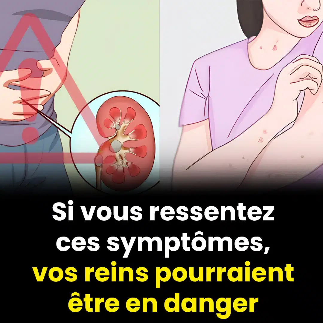Les premiers signes d’un problème aux reins et comment vous protéger