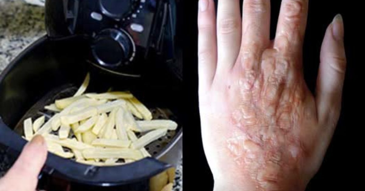 Les risques méconnus de la cuisson à l'Airfryer