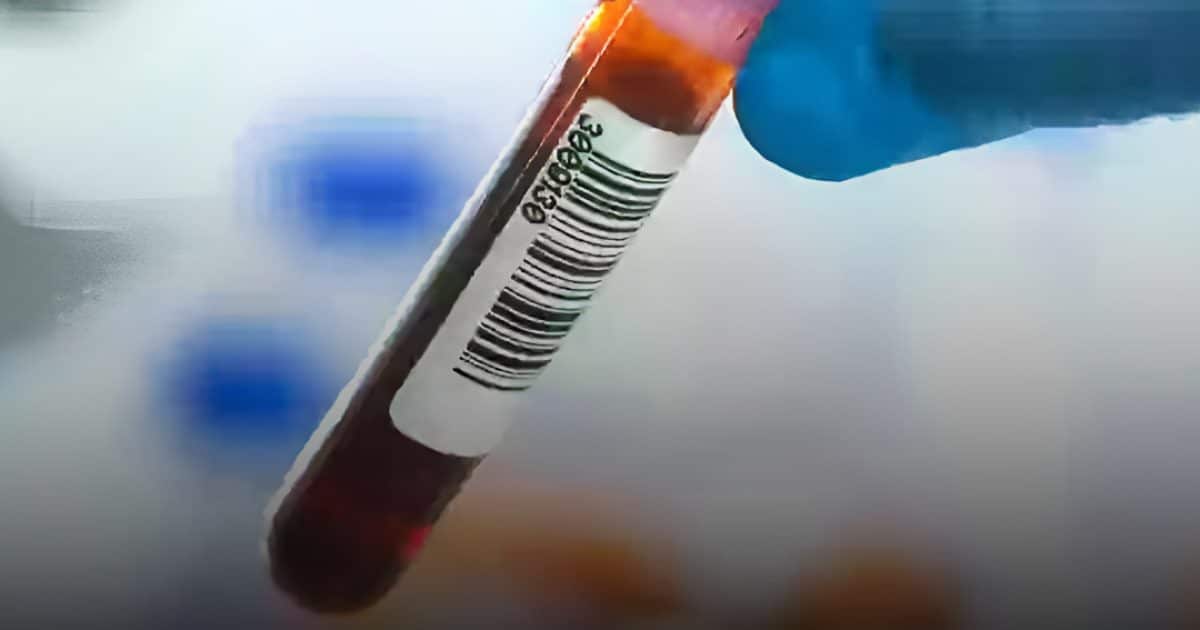 Les scientifiques révèlent le groupe sanguin qui présente le risque le plus faible de maladie cardiaque